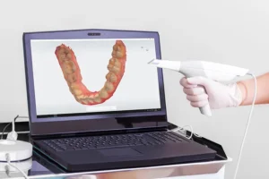 Read more about the article 5 Common 3D Scanning Mistakes and How to Avoid Them